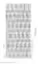 Fig. 21 - Flexible and expandable stent