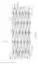Fig. 25 - Flexible and expandable stent