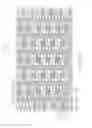 Fig. 36 - Flexible and expandable stent