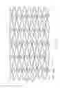 Fig. 41 - Flexible and expandable stent