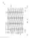 Fig. 47 - Flexible and expandable stent