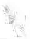 Fig. 07 - Apparatus and method for deploying an implantable device within the body