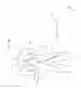 Fig. 19 - Apparatus and method for deploying an implantable device within the body