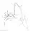 Fig. 20 - Apparatus and method for deploying an implantable device within the body