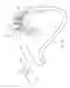 Fig. 22 - Apparatus and method for deploying an implantable device within the body
