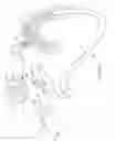 Fig. 24 - Apparatus and method for deploying an implantable device within the body