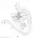 Fig. 29 - Apparatus and method for deploying an implantable device within the body