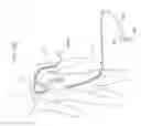 Fig. 31 - Apparatus and method for deploying an implantable device within the body