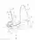 Fig. 33 - Apparatus and method for deploying an implantable device within the body