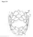 Fig. 24 - Percutaneously deliverable heart valve including folded membrane cusps with integral leaflets