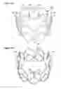 Fig. 27 - Percutaneously deliverable heart valve including folded membrane cusps with integral leaflets