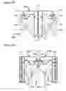 Fig. 28 - Percutaneously deliverable heart valve including folded membrane cusps with integral leaflets
