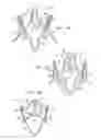Fig. 03 - Methods of treating a native aortic valve insufficiency