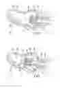 Fig. 09 - Methods of treating a native aortic valve insufficiency