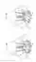 Fig. 12 - Methods of treating a native aortic valve insufficiency