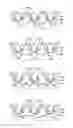 Fig. 17 - Methods of treating a native aortic valve insufficiency