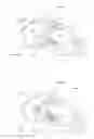 Fig. 04 - DEVICES, SYSTEMS, AND METHODS FOR RETAINING A NATIVE HEART VALVE LEAFLET