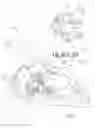 Fig. 06 - DEVICES, SYSTEMS, AND METHODS FOR RETAINING A NATIVE HEART VALVE LEAFLET