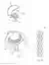 Fig. 12 - DEVICES, SYSTEMS, AND METHODS FOR RETAINING A NATIVE HEART VALVE LEAFLET