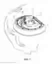 Fig. 08 - Ear molding device for correcting misshaped ears