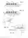Fig. 07 - Joint support and subchondral support system