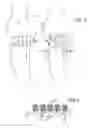 Fig. 09 - Joint support and subchondral support system
