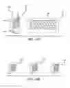 Fig. 13 - Joint support and subchondral support system