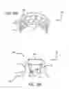 Fig. 27 - Joint support and subchondral support system