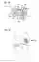 Fig. 28 - Joint support and subchondral support system