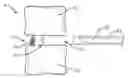 Fig. 01 - Interbody containment implant