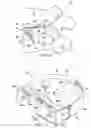 Fig. 04 - Artificial spinal disk prosthesis