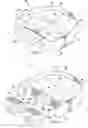 Fig. 06 - Artificial spinal disk prosthesis