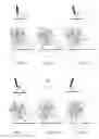 Fig. 07 - Articulated prosthesis or orthosis joint