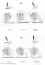 Fig. 08 - Articulated prosthesis or orthosis joint