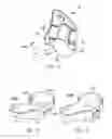 Fig. 02 - Knee implant system