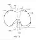 Fig. 08 - Knee implant system