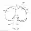 Fig. 09 - Knee implant system