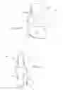 Fig. 08 - Malleolar replacement devices