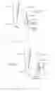 Fig. 09 - Malleolar replacement devices