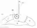 Fig. 01 - Method and instrumentation for acetabular labrum reconstruction