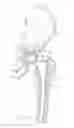 Fig. 02 - Acetabular liner system
