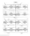 Fig. 03 - Background audio processing