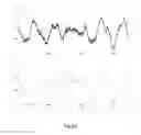Fig. 16 - Electronic device and copyright protection method of audio data thereof