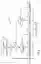 Fig. 04 - Hybrid vehicle and method of control for engine transient mitigation