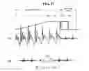 Fig. 33 - Method and an apparatus for processing an audio signal