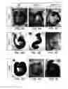 Fig. 06 - HEDGEHOG INHIBITOR ASSAY