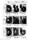 Fig. 07 - HEDGEHOG INHIBITOR ASSAY