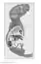 Fig. 01 - GLOBAL NAV1.7 KNOCKOUT MICE AND USES