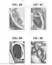 Fig. 08 - GLOBAL NAV1.7 KNOCKOUT MICE AND USES