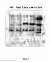 Fig. 03 - ALUMINIUM TOLERANT BARLEY